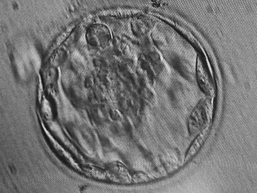 Blastocyst.JPG
