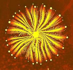 A colony of bacteria similar to the one analyzed in the study being discussed. (click for credit)