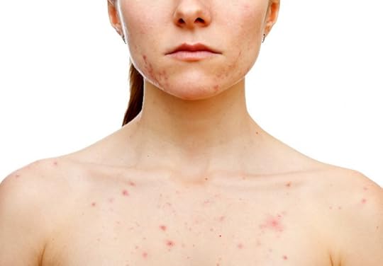dr-ohhira-probiootikum-kollageen-soolestik-tervis-ilu-tähtsus-akne-psoriaas-ülekaalulisus-vererõhk-haigus-tervenemine-tervis-paljas-porgand-merilin-taimre-blogi