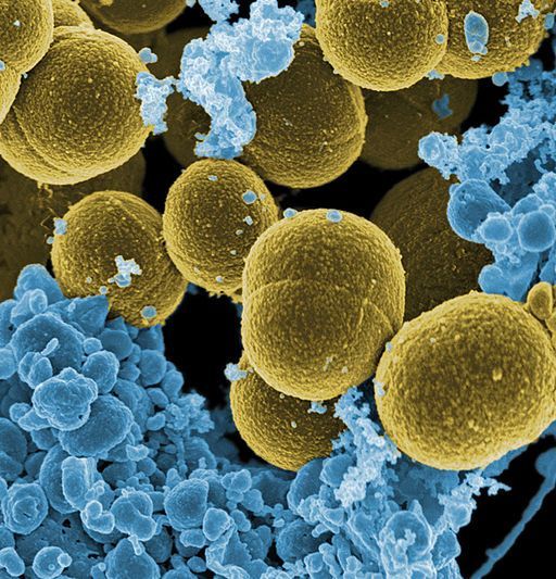 Image credit: Stapylococcus aureus bacteria escape. Public Domain via Wikimedia Commons