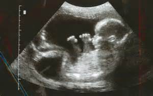 unborn baby