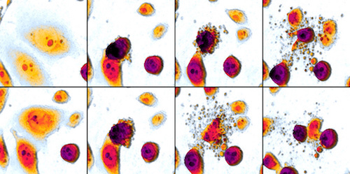 Apoptosis_DU145_cells_mosaic.jpg