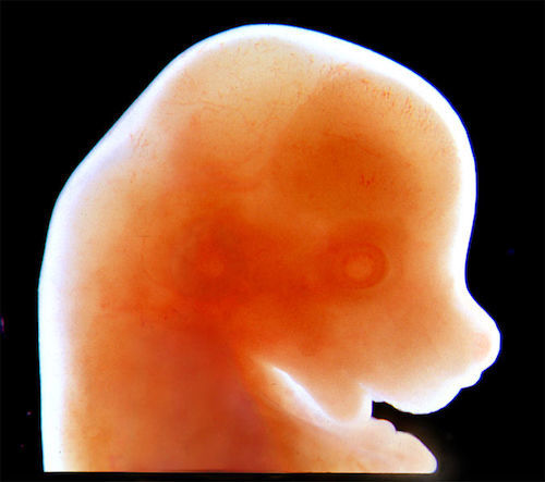 Craniofacial_mouse_embryo.jpg