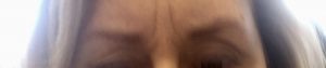 Brow