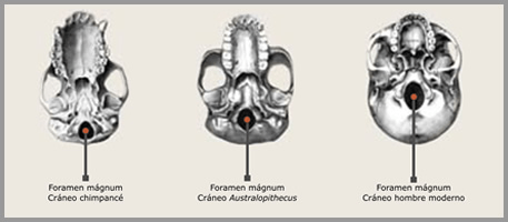 Foramen magnum positioning