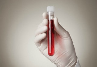 Inline_Blood_Test_Primer