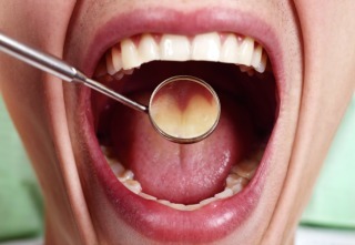 Healthy man teeth and a dentist mouth mirror