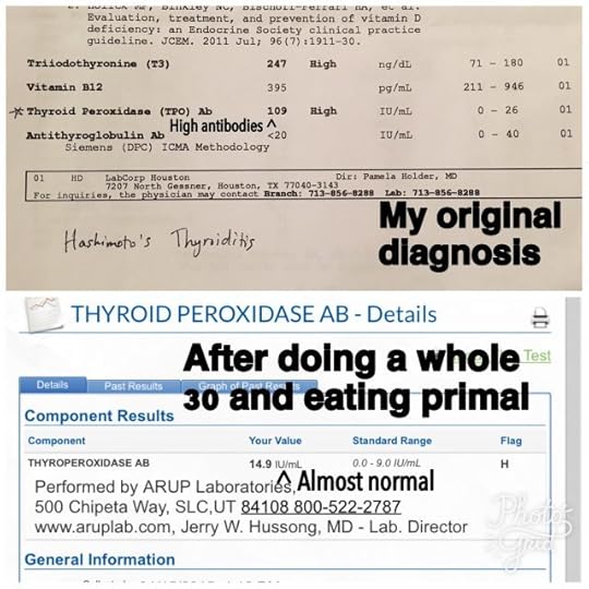 Thyroid_original
