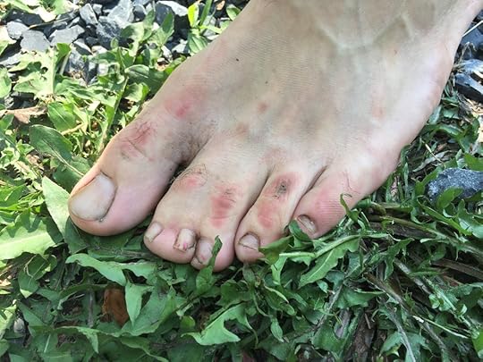 A picture of ET's Extra Toe.