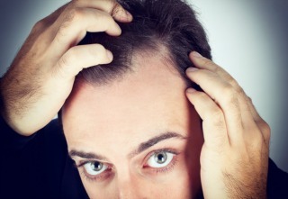 Caucasian young man controls hair loss