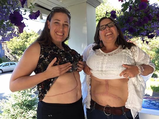 Me and my own personal wonderwoman rocking our scars.