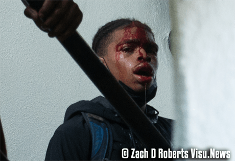 DeAndre Harris, semi-conscious and bleeding.