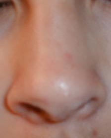 File:Human-nose.jpg