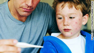 The (very few) upsides to childhood illnesses