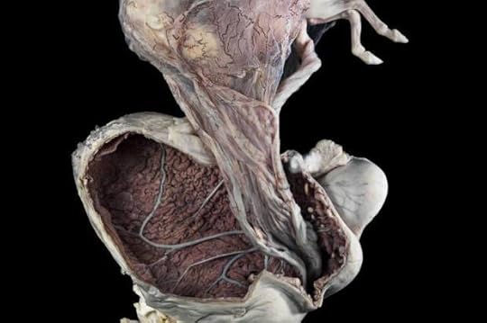 A0001337 Pregnant uterus, equine