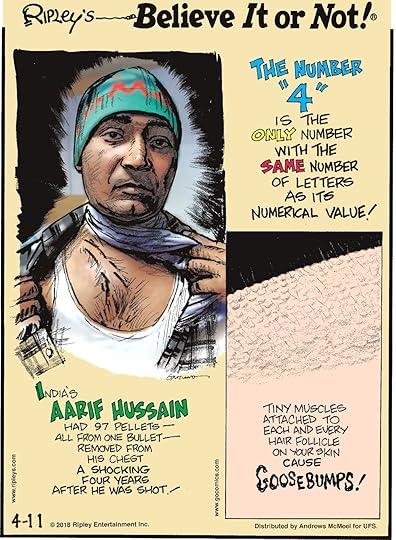 India's Aarif Hussain had 97 pellets - all from one bullet - removed from his chest a shocking four years after he was shot!-------------------- The number 