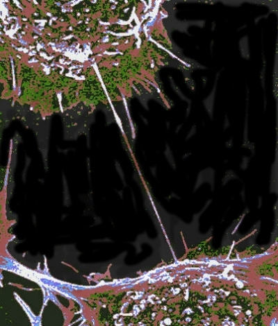 tunneling nanotubes colourized #2.jpg