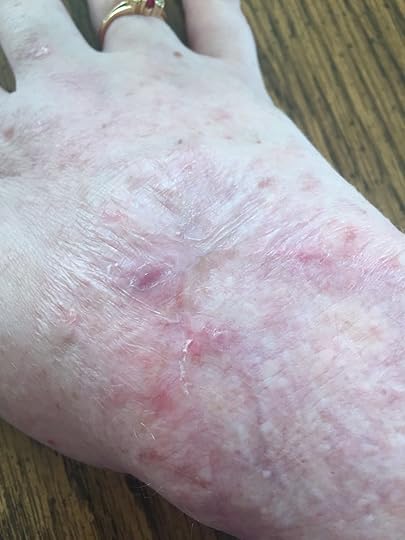 It's not lovely, but it's still attached....