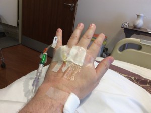 Cancer chemo hand