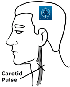 Circulation - First Aid DRABC - Survival Fitness Plan Remote Area First Aid Training