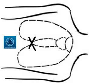 First Aid DRABC - How to do CPR 2 - Survival Fitness Plan Remote Area First Aid Training