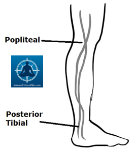 How to Control Severe Bleeding 2 - Survival Fitness Plan Remote Area First Aid Training
