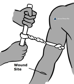 How to Control Severe Bleeding 3 - Survival Fitness Plan Remote Area First Aid Training