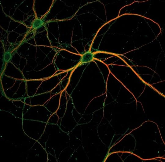 Photograph of a stained neuron