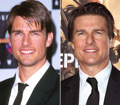 age
