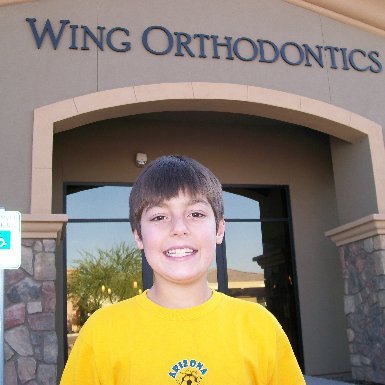 no more braces