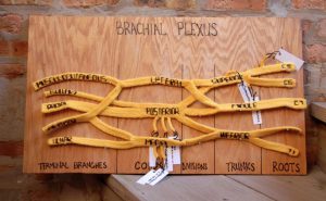 Knitted Brachial Plexus