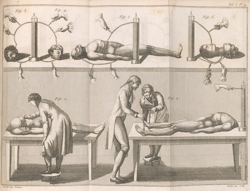 Aldini, Giovanni, 1762-1834. Essai theorique et experimental sur le galvanisme
