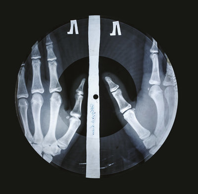X-ray Audio