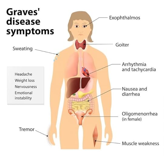 Graves' Disease: The Cause, Symptoms, Labs and First Steps to Take 