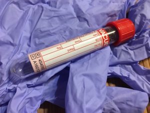 chances of getting a knee replacement infection