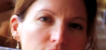 Botox, Migraines and Insight 
