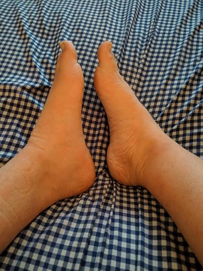 The size disparity between my injured foot and my uninjured foot is comical. The injured foot is huge, like it belongs on another person, both in length and width.