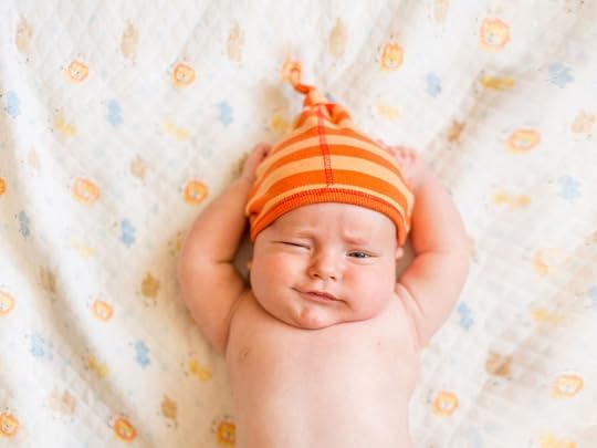 What Is the Cause of Cradle Cap in Babies?