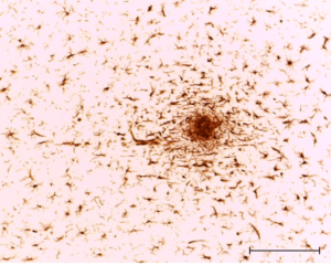 Microglial cells migrate to area of ischemic inflammation.