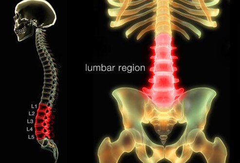Low Back Pain: Symptoms, Causes, Treatment, Relief