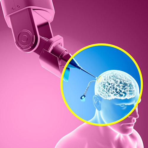 Futurist Speaker Thomas Frey Blog: Brain Implant with Flexible Electrodes the Ultimate Brain to Information Communication