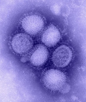 612px H1N1 influenza virus