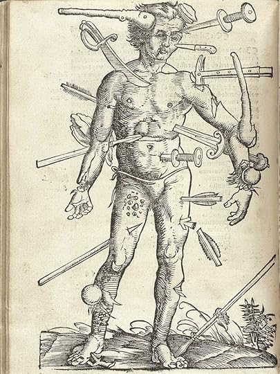 Hans von Gersdorff's Feldtbuch der Wundartzney (Strasburg, 1519)
