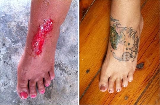 After cutting my foot badly in Thailand I eventually had a tattoo over the scar