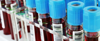 Blood in test tubes resized_0