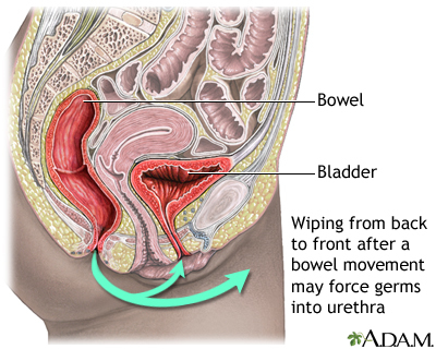 bladder infection