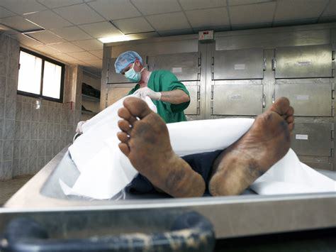 Coroners must send bodies for scans rather than autopsies ...