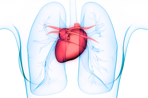 Heart-lungs-xray-teaser