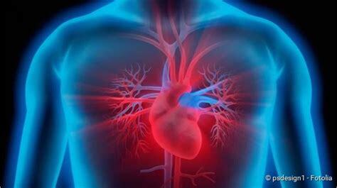 Myocarditis: symptoms, triggers, risks - iMS