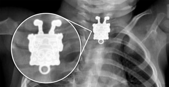 Spongebob Xray